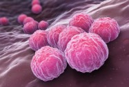 Шведски учени ще активират имунитета срещу рак