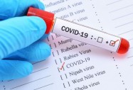 Вирусолог:  COVID-19 ще мутира до състояние на простуда
