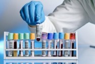 Уникален PCR тест открива бързо причинителя на  пневмонията